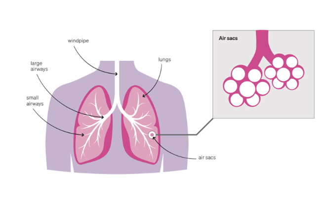 The illustration shows the lungs. There is a close-up illustration showing the airway sacs.