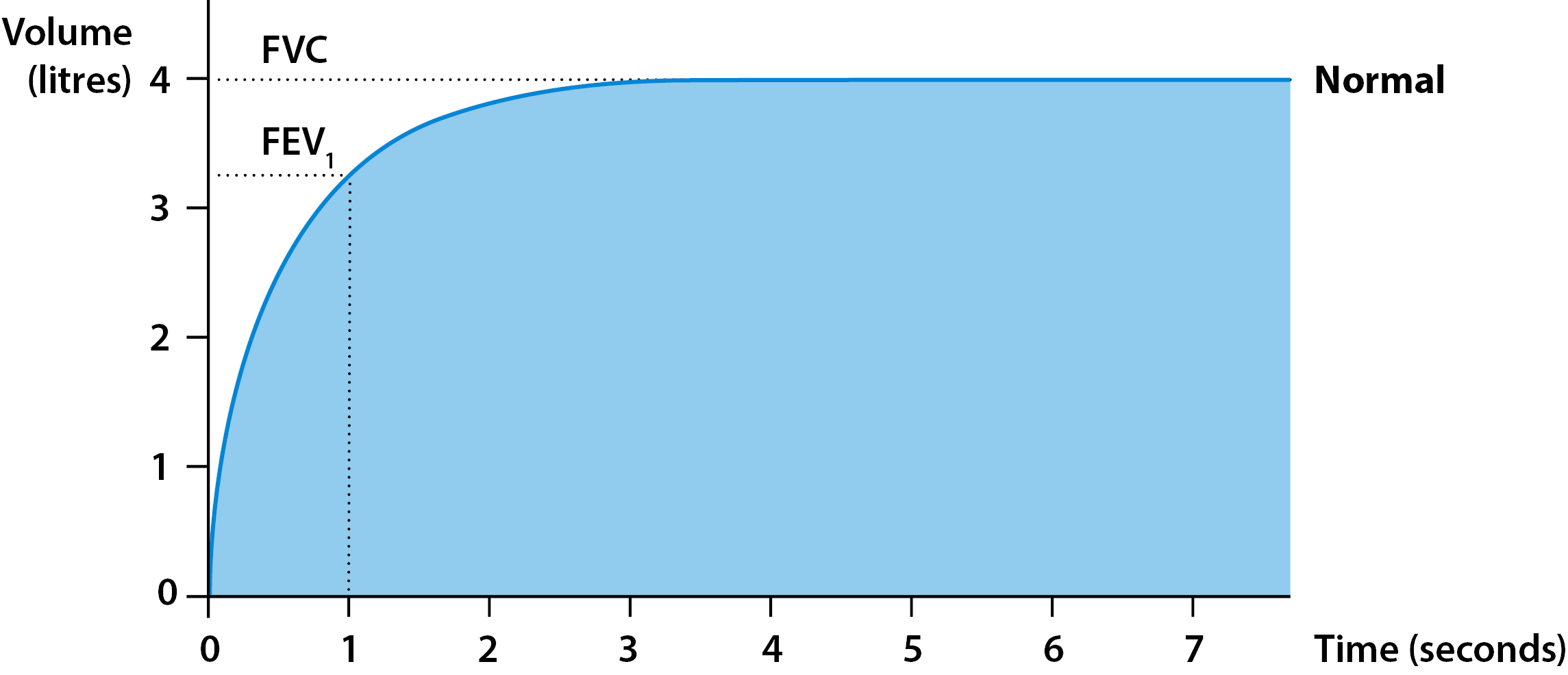 Spirometry and bronchodilator responsiveness testing Asthma + Lung UK