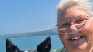 Smiling woman with nasal canula beside dog outside on a sunny day