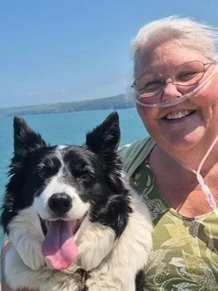 Selfie of a woman wearing a nasal cannula next to a dog